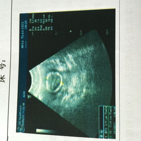 journal_insert_pic_217919890