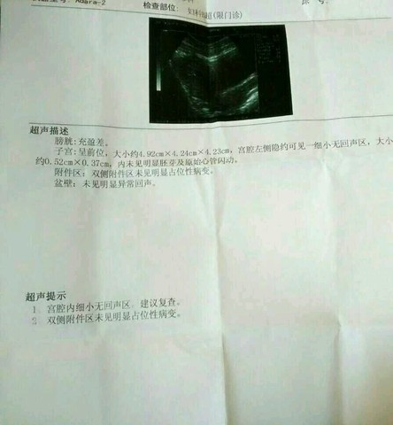 journal_insert_pic_219401815