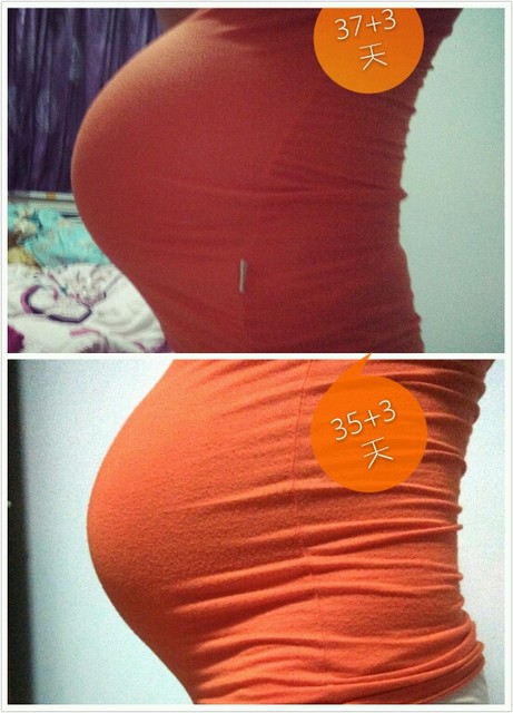 37周肚肚 典型鸡蛋肚