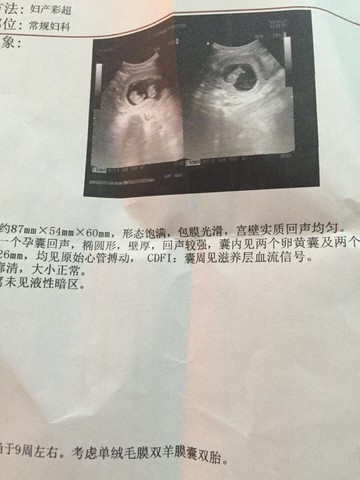 journal_insert_pic_222537831