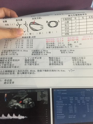 journal_insert_pic_223690067
