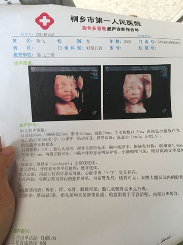 journal_insert_pic_230809153