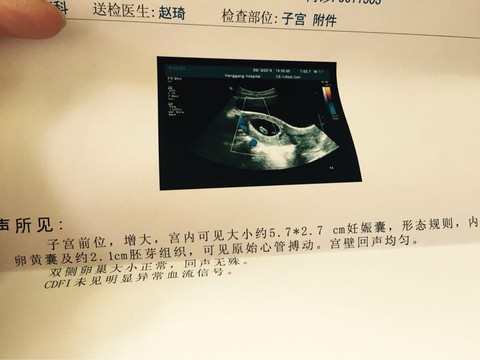 journal_insert_pic_231651226