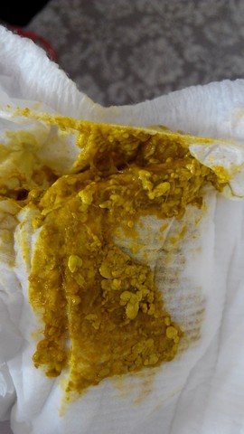 关于小宝贝粑粑的知识,重口味没有需要的不要进来