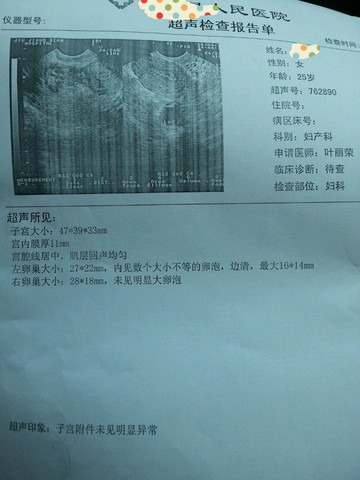 journal_insert_pic_236735583