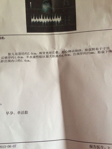 journal_insert_pic_244759003