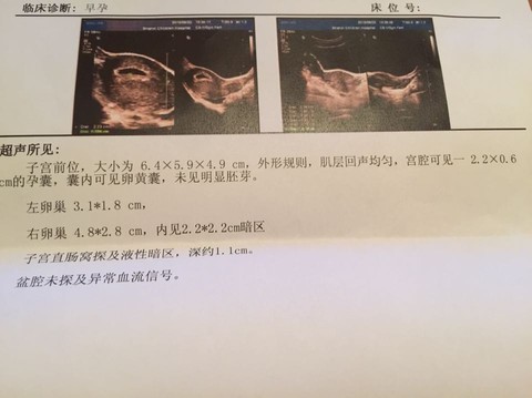 journal_insert_pic_247745273
