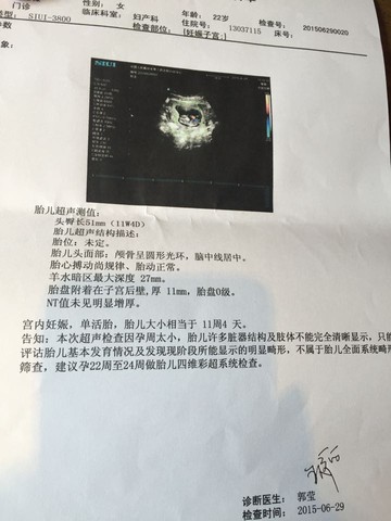 journal_insert_pic_250207036