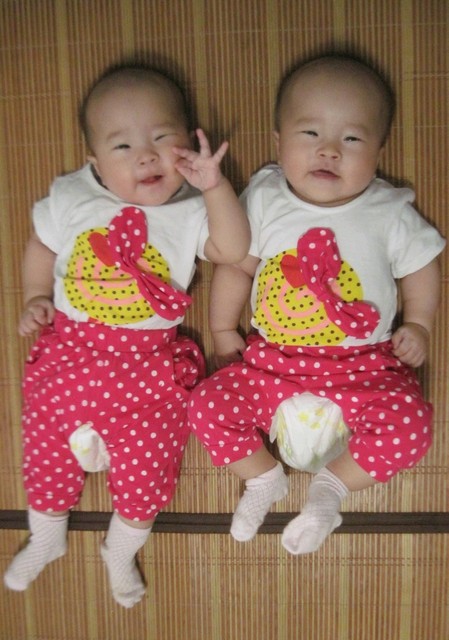 树下 小圈子 家有双胞胎 今天b超,双胎女儿,我该怎么办,要还是不要