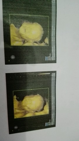 journal_insert_pic_255151893