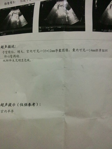 journal_insert_pic_255046843