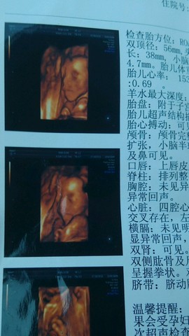 journal_insert_pic_262409434