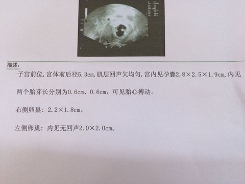 journal_insert_pic_264810270