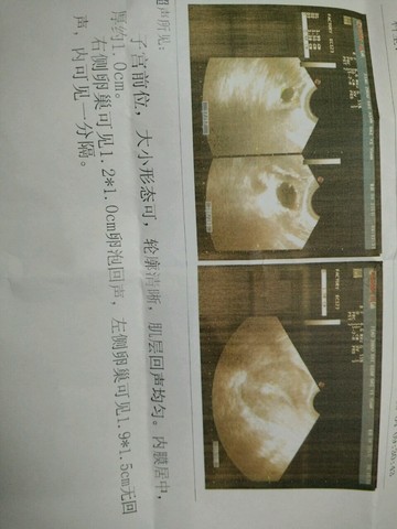 journal_insert_pic_265127455