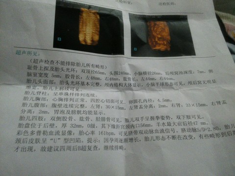 journal_insert_pic_265356714