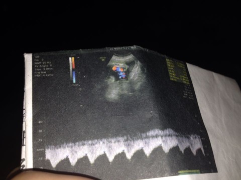journal_insert_pic_270015095