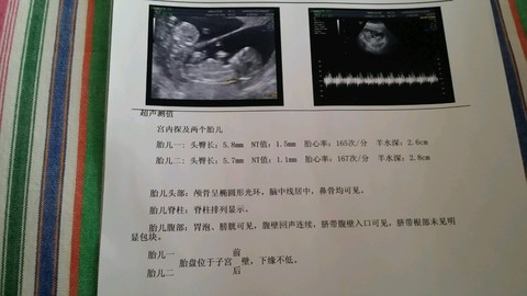 journal_insert_pic_279919159