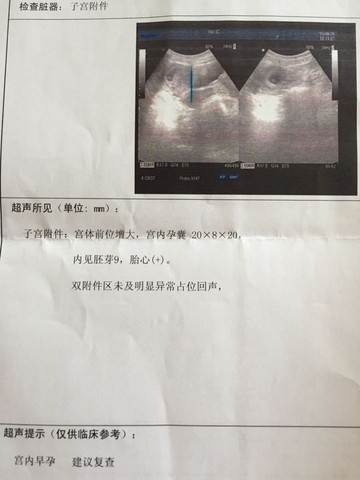 journal_insert_pic_279228075