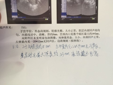 journal_insert_pic_280552287