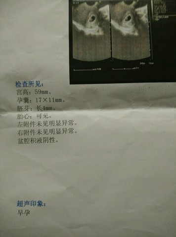 journal_insert_pic_281102305