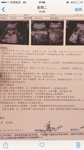 journal_insert_pic_289474677
