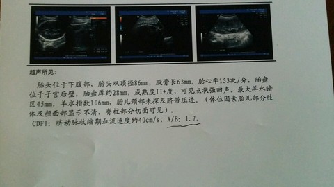 journal_insert_pic_301018916
