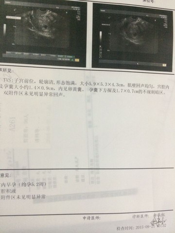 B超计算孕周是按胚胎实际大小推算还是按受精日还是末次月经 宝宝树