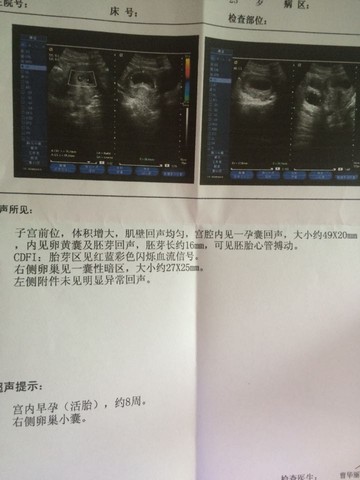 journal_insert_pic_305135989