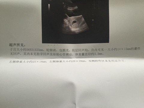 journal_insert_pic_306709475