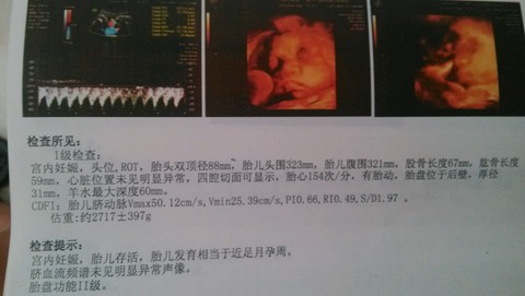 journal_insert_pic_307892626