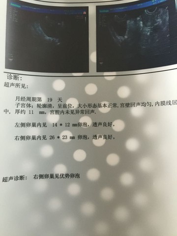 journal_insert_pic_308939798