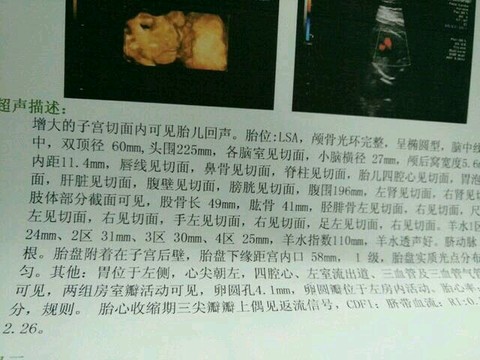 journal_insert_pic_312064463