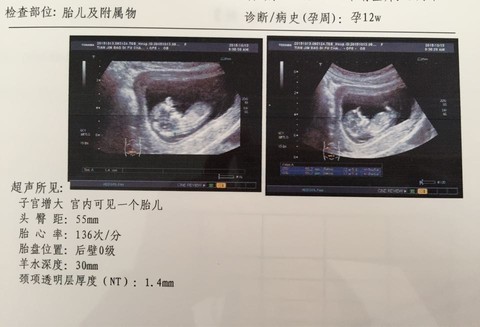 journal_insert_pic_316591723