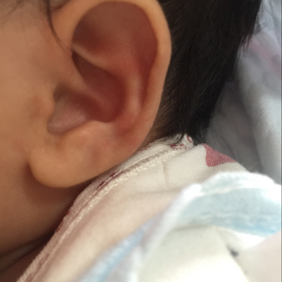1个月婴儿油耳朵图片图片