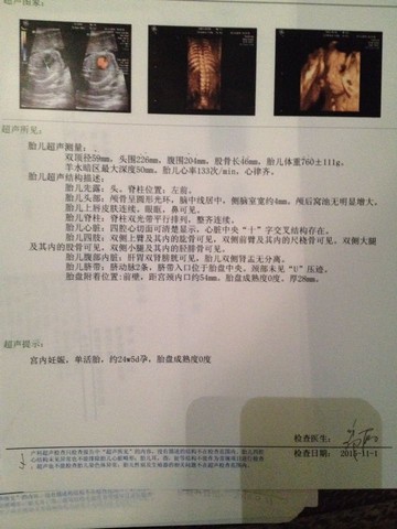 journal_insert_pic_329444488