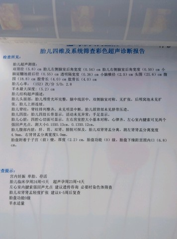 journal_insert_pic_330045979