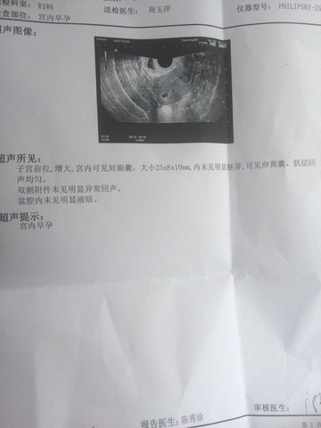 journal_insert_pic_333079923