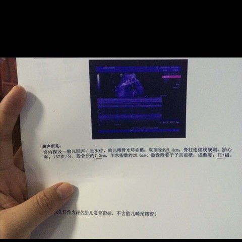 journal_insert_pic_339708743