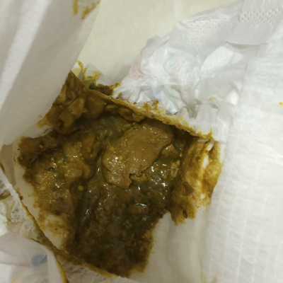 宝宝三个半月两天没拉屎,后来一拉这样了!是肚子坏了吗?