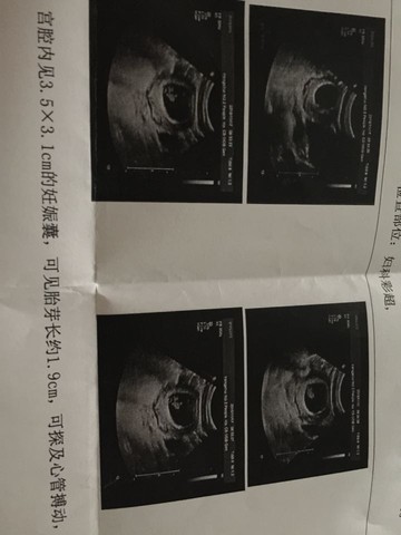 journal_insert_pic_339803601