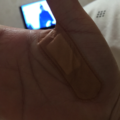 怀孕7个半月,手掌被玻璃渣扎伤,可以肯定的是玻璃渣没进到手掌肉里,用