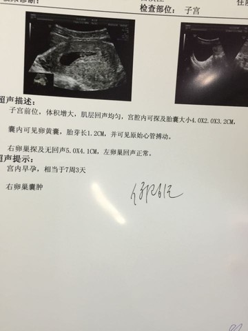 journal_insert_pic_341291432