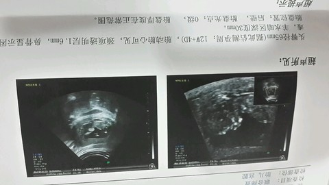 journal_insert_pic_342287348