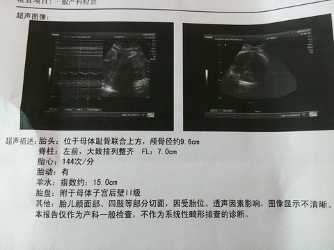 journal_insert_pic_348451071