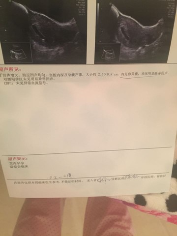 journal_insert_pic_349383451