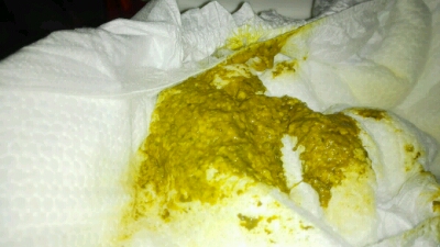 宝宝已经23天了,看网上都是正常的大便是金黄色软膏状,我看我们家不像