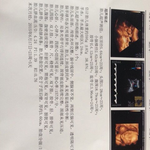 journal_insert_pic_350686301