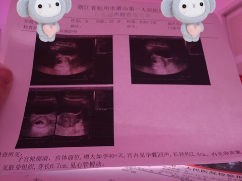 journal_insert_pic_353212394