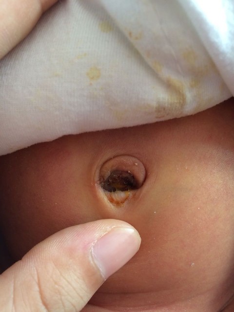 初生才11天就住院六天,做父母的真心觉得失败!