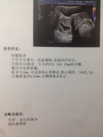 journal_insert_pic_358113947
